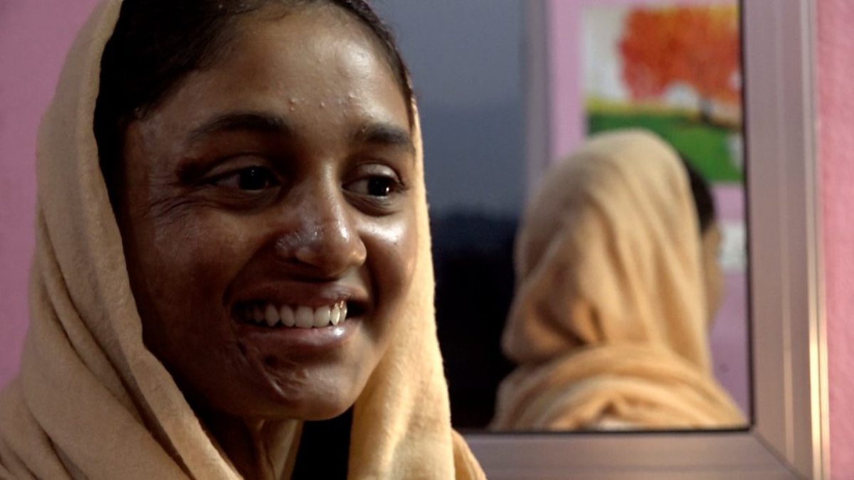 मुस्कान खातुनको उपचारका लागि वीरगञ्जका मेयरले गरे दुई लाख रुपैयाँ सहयोग